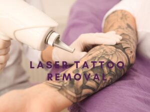 Laser Tattoo Removal in Dallas, TX: Your Guide to Safe and Effective Tattoo Removal