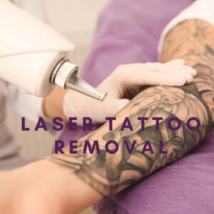 Laser Tattoo Removal in Dallas, TX: Your Guide to Safe and Effective Tattoo Removal